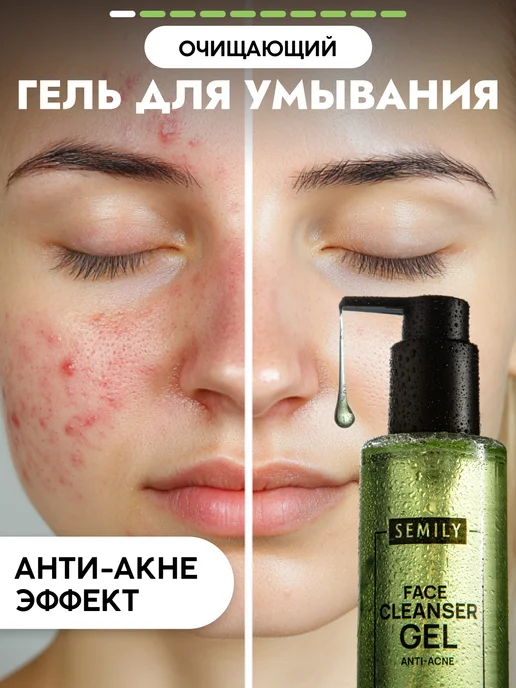 Гель для умывания от прыщей 200мл