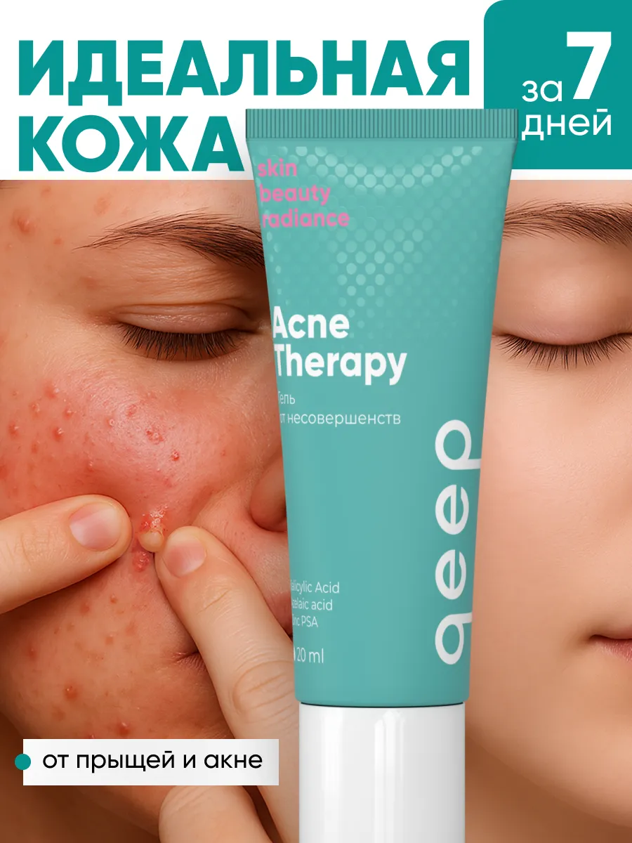 Крем от прыщей и акне для лица и тела